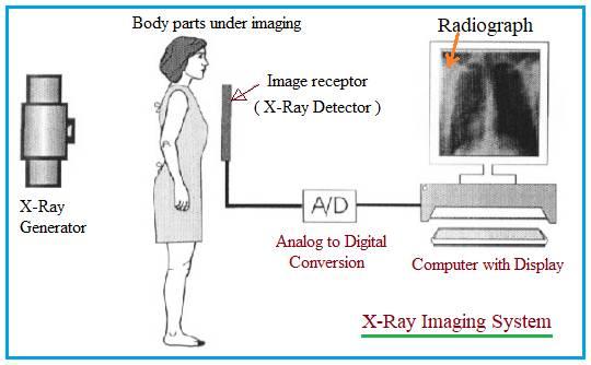 X-Ray Technology: Principles, Applications, and Safety
